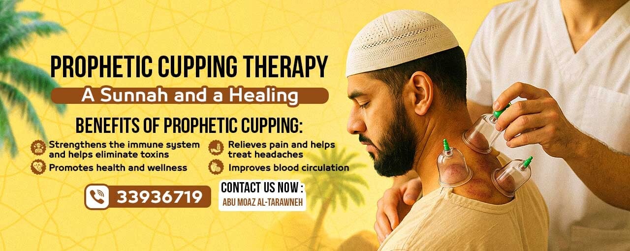hijama