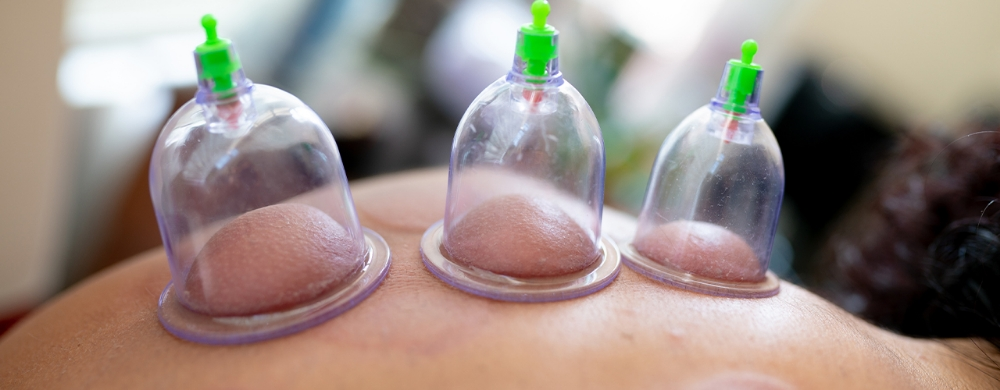 Cupping Therapy  - 5
