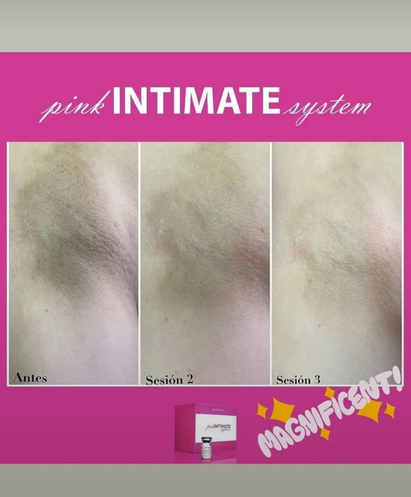 whitening.... - 3