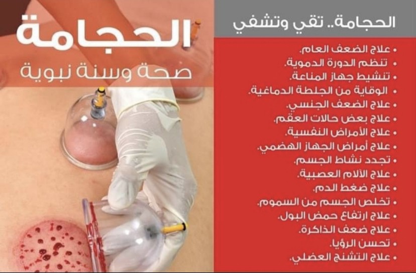 الحجامة الشرعية النبوية  - 3