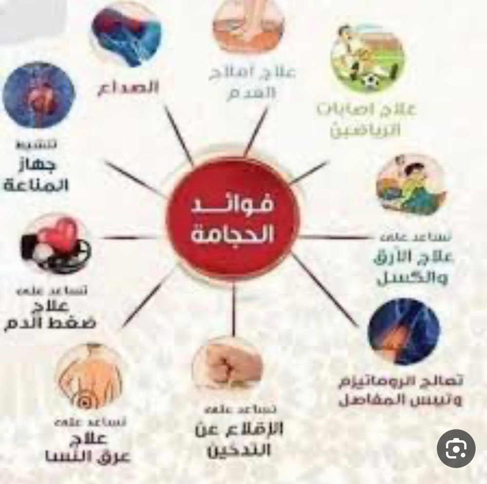 حجامه للنساء - 6