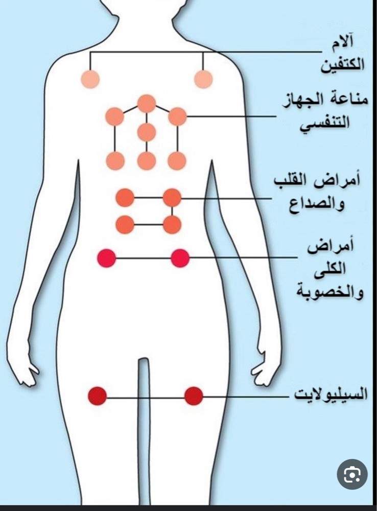 حجامه للنساء - 5