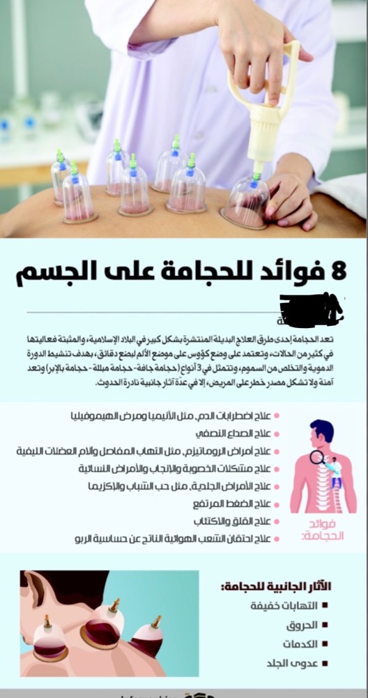حجامه للنساء - 4