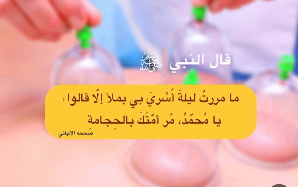 حجامه للنساء - 3