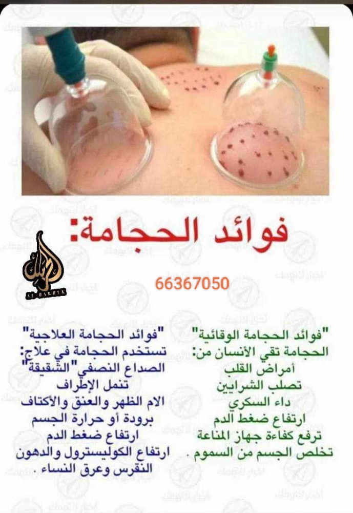استشاره مجانيه للحجامه النبويه - 2