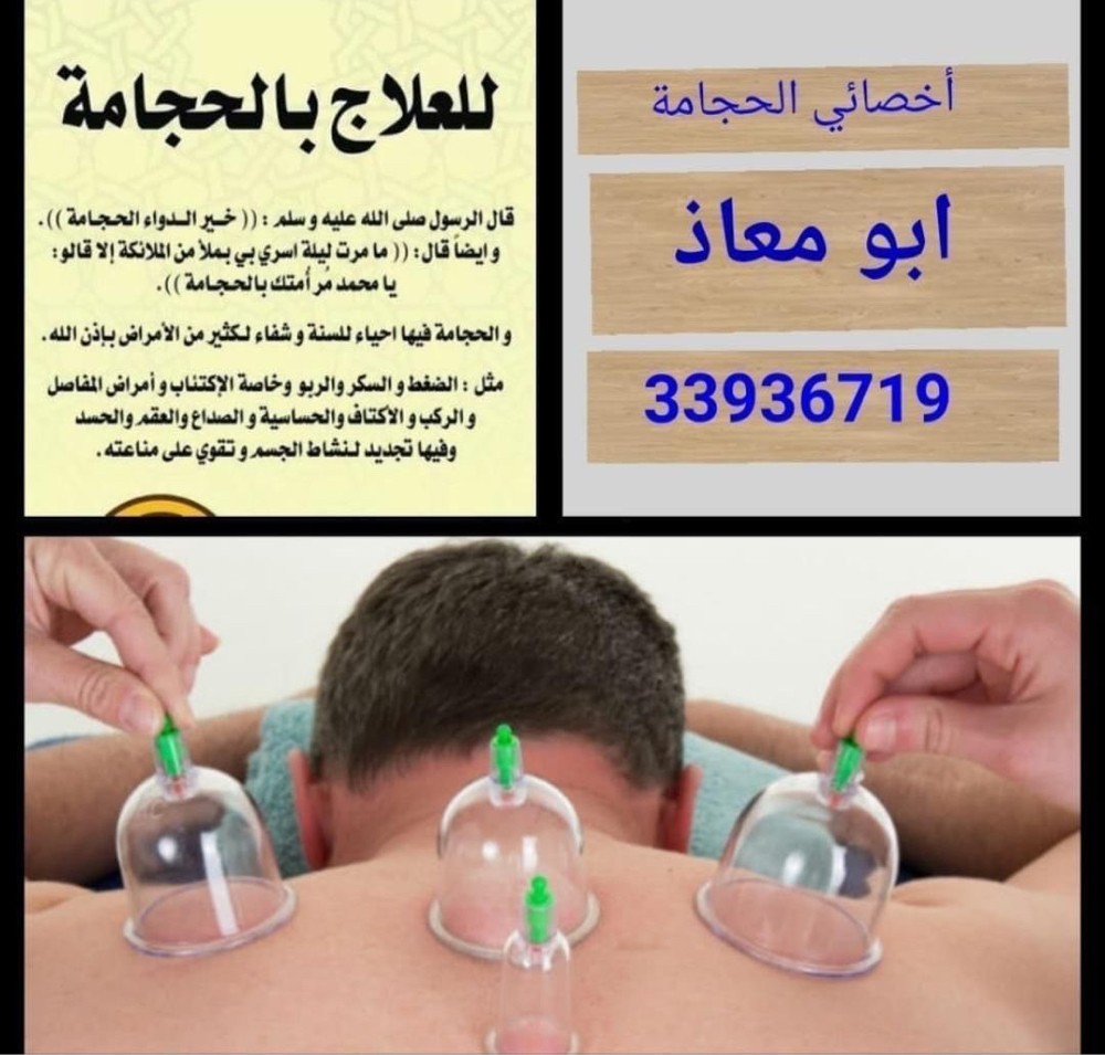 حجامه راس بدون حلاقة رقيه شرعيه - 1