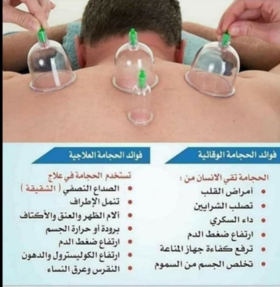 الحجامه الاسلاميه - 1