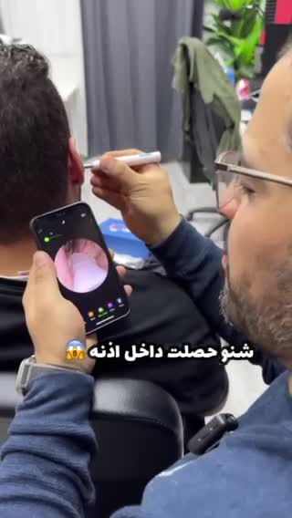 smart ear wax removal - 5