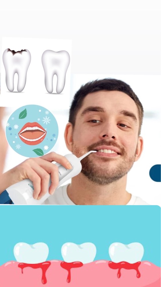 water teeth flosser - 2