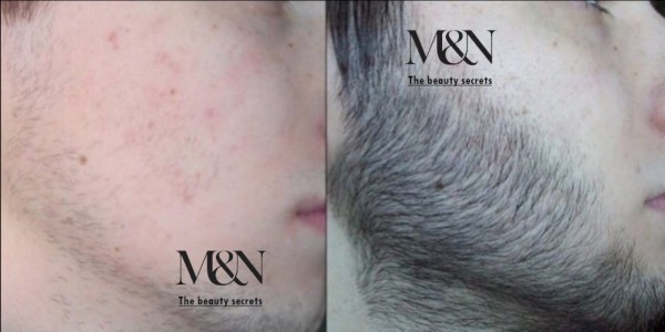 Natural Beard Care Products - 6
