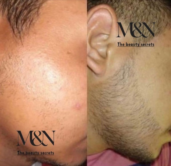 Natural Beard Care Products - 5