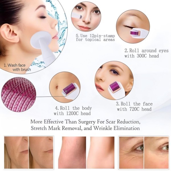 6-in-2 Derma Roller System - 5
