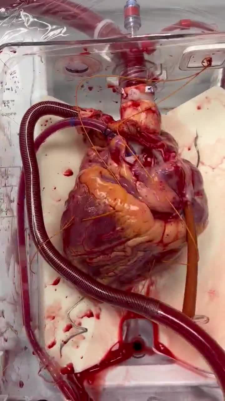 العابد - 1