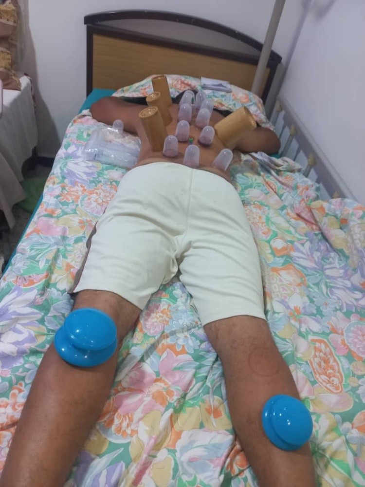 hijama - 2
