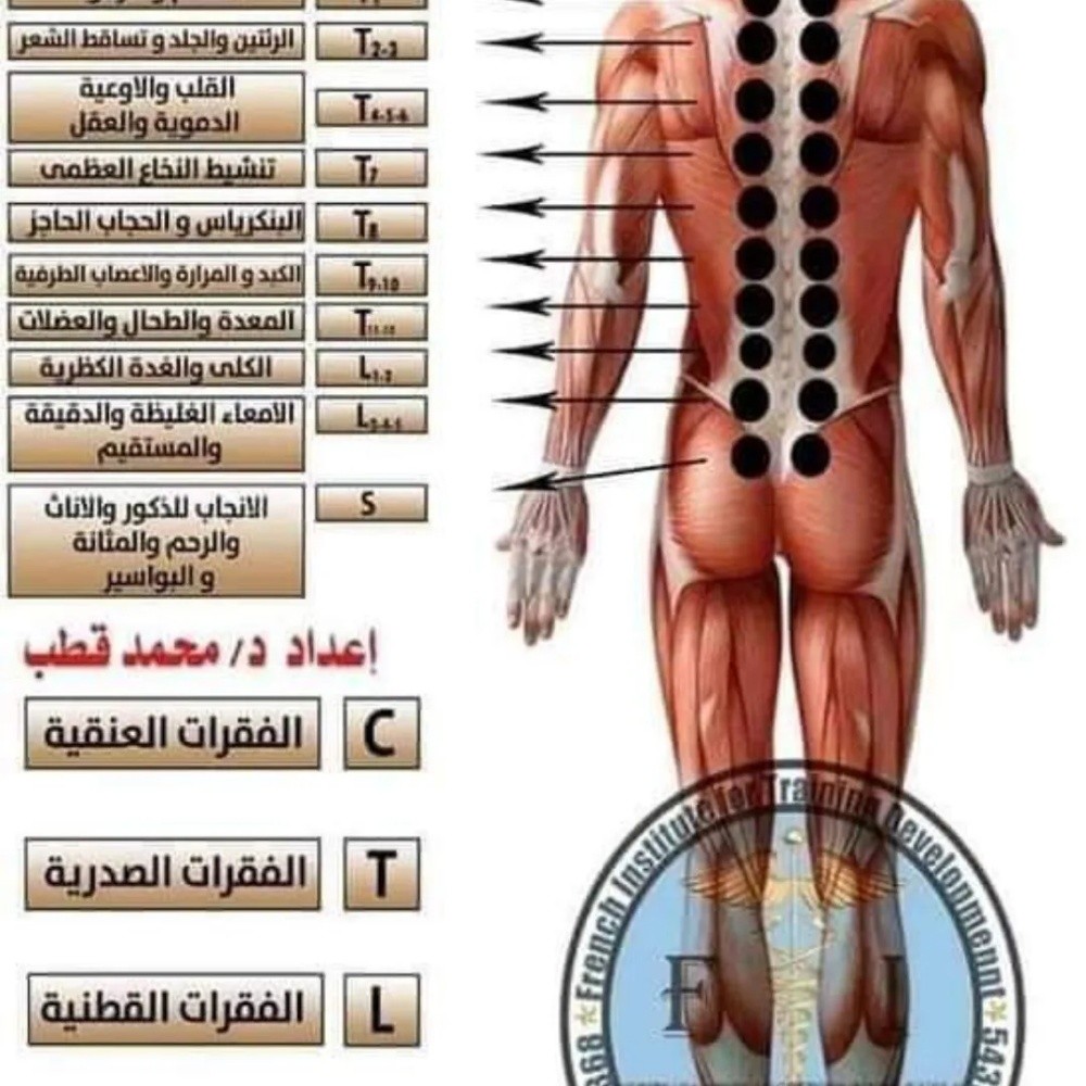 حجامة نبوية - 1