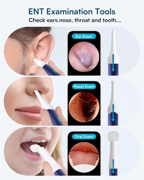 Bebird Smart Ear Cleaner - 6