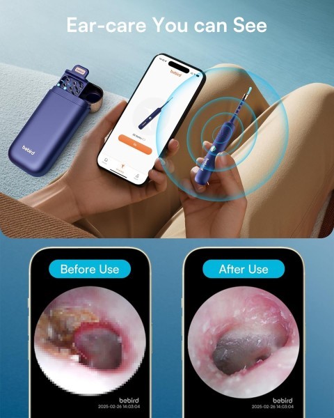 Bebird Smart Ear Cleaner - 5