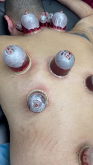 حجامةً لمن أراد السلامة  - 3
