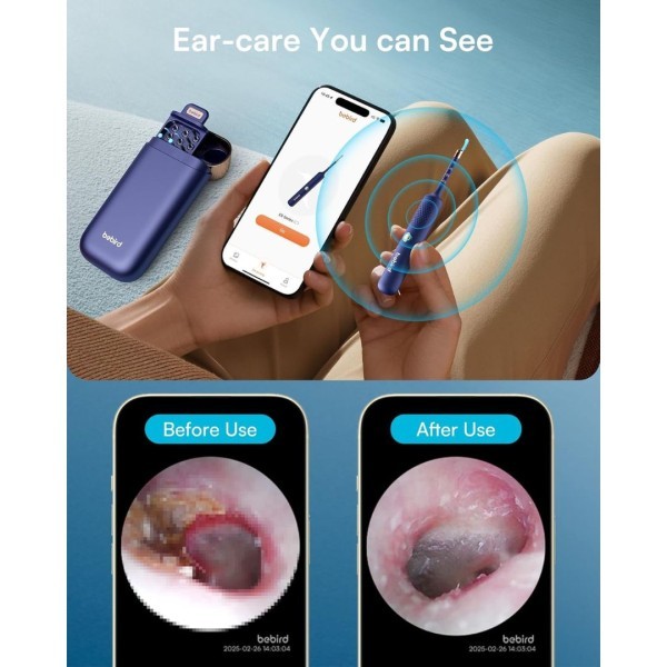 Bebird Smart Visual Ear Cleaner - 3