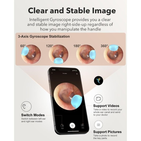 Bebird Smart Visual Ear Cleaner - 4