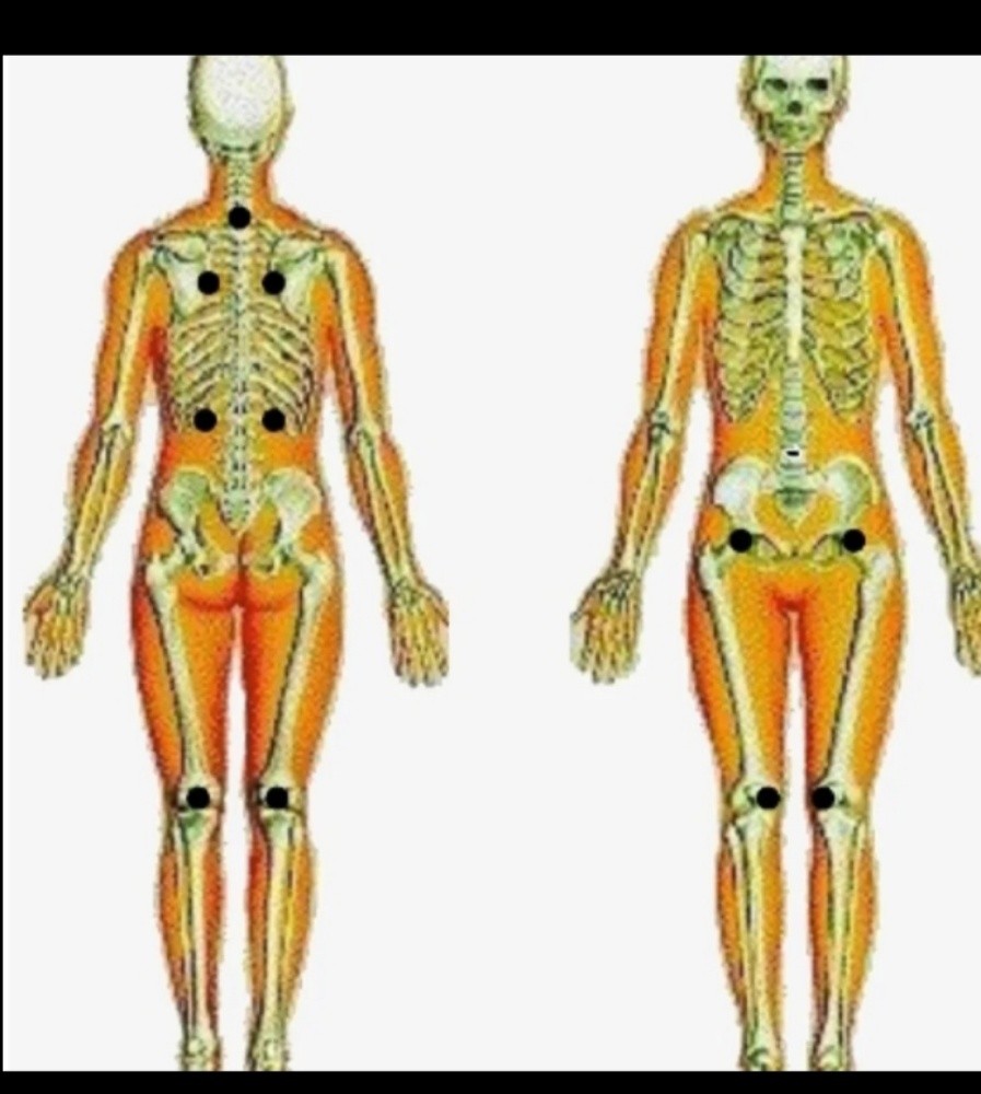 حجامه نبويه علاجيه ووقائيه - 2