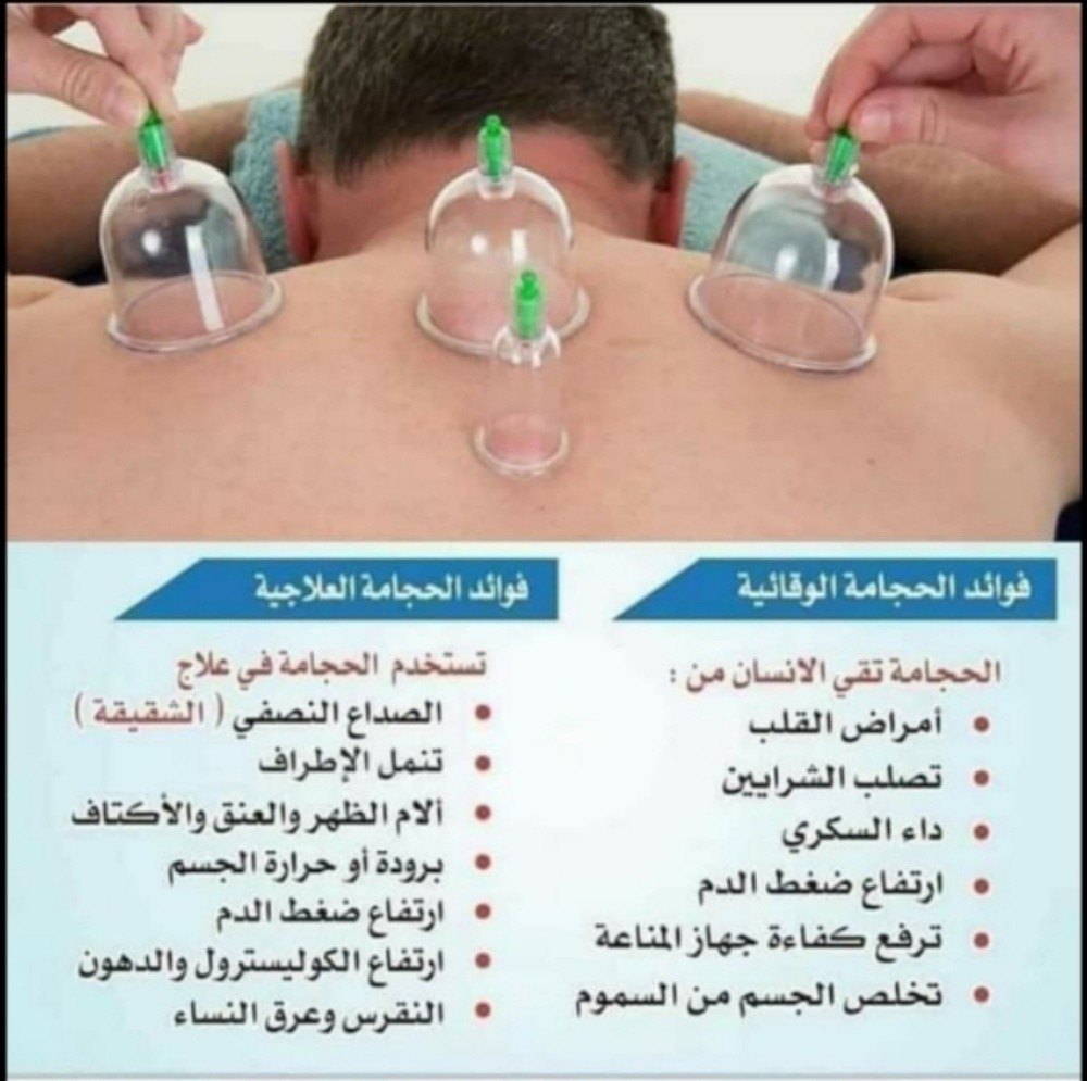 حجامه نبويه علاجيه ووقائيه - 3