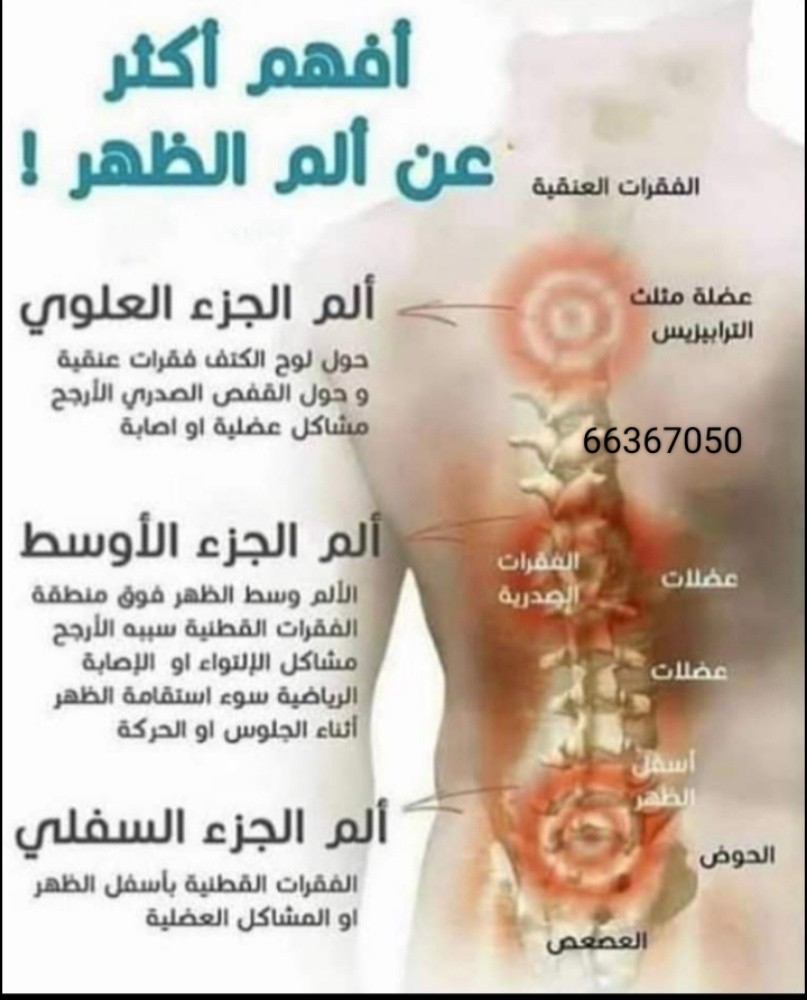 استشاره مجانيه للحجامه النبويه - 1