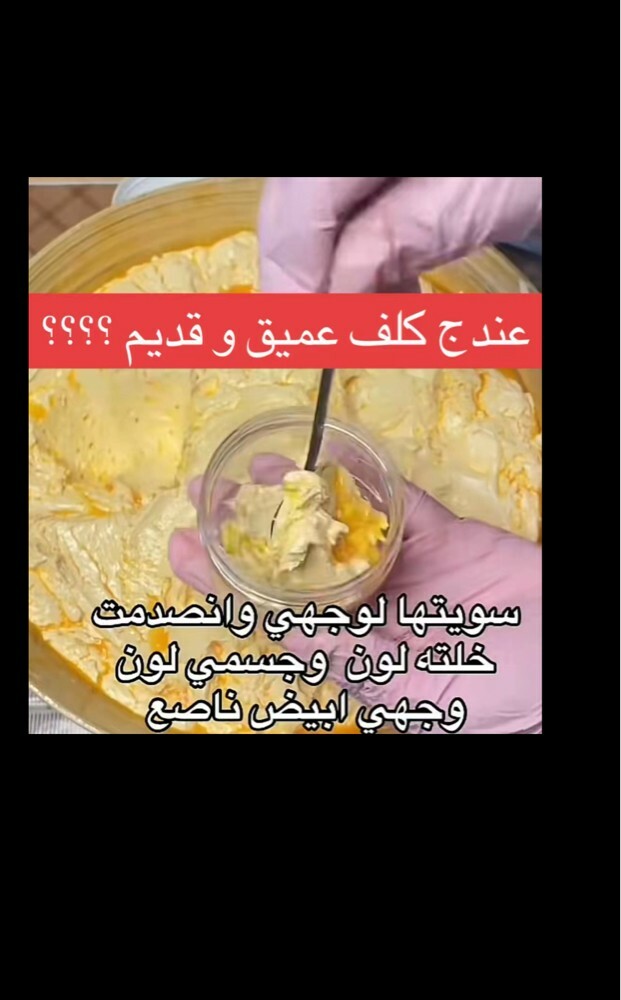 melasma removal cream - 5