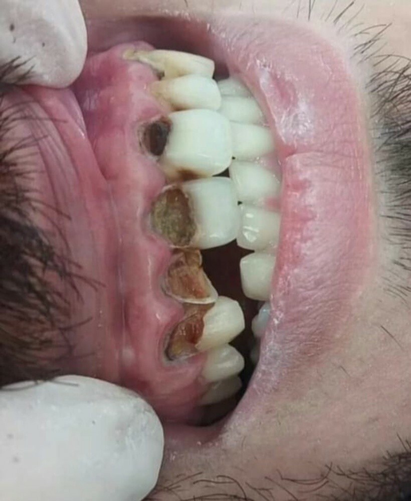مدكور بن أعمر - 5