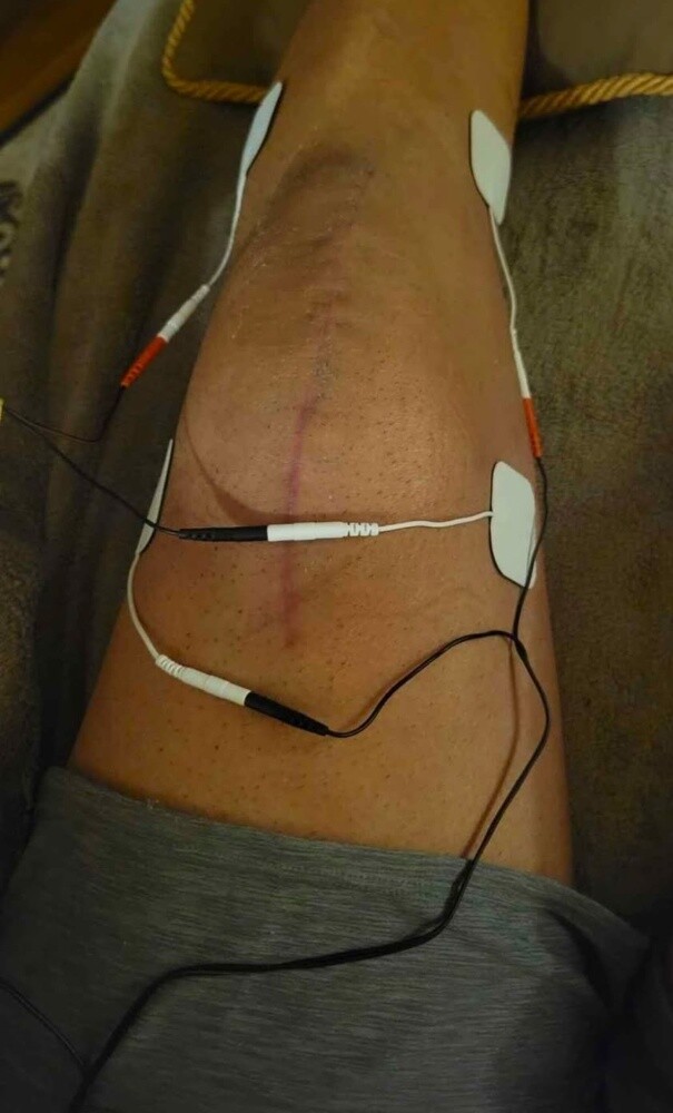 جهاز العلاج الكهربائي - 7