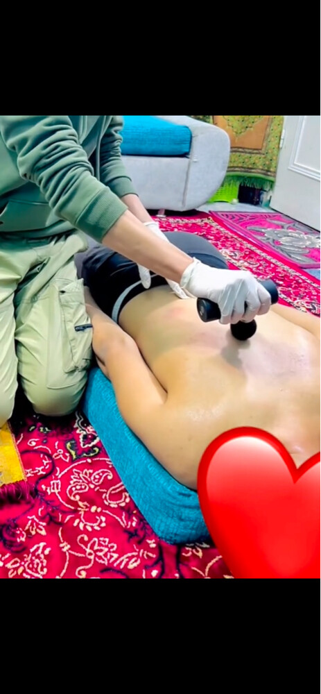 حجامه جافه وتشريطيه  - 2