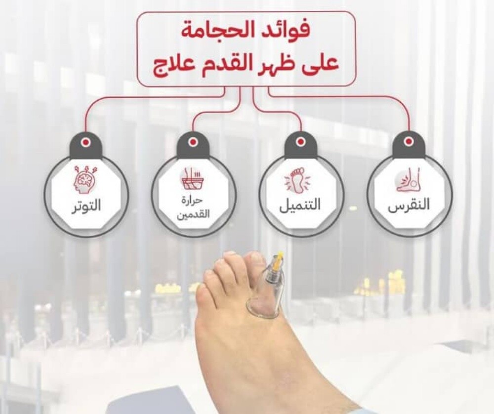 التداوي بالحجامه - 18