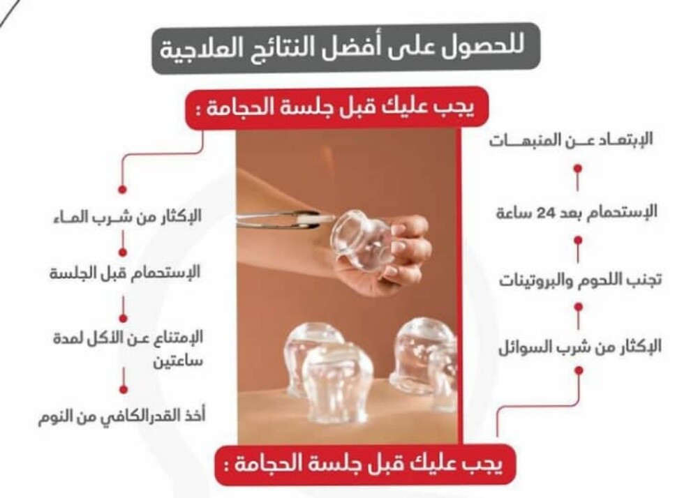 التداوي بالحجامه - 10
