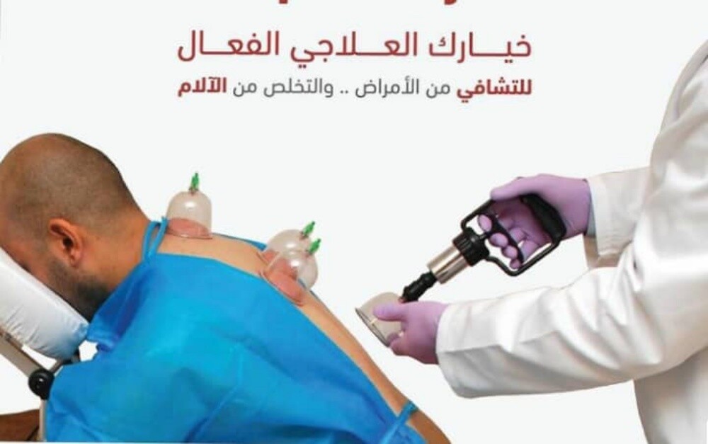 التداوي بالحجامه - 11