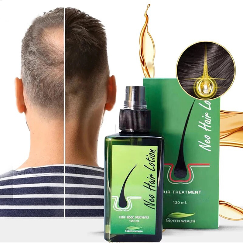 Neo Hair Lotion - 3