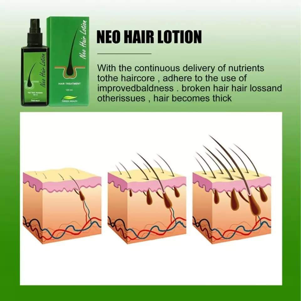 Neo Hair Lotion - 6