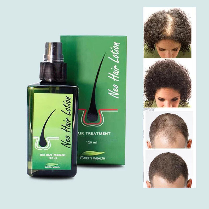 Neo Hair Lotion - 2