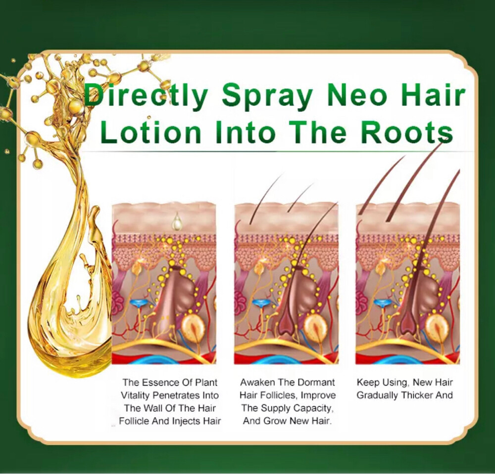 Neo Hair Lotion - 5