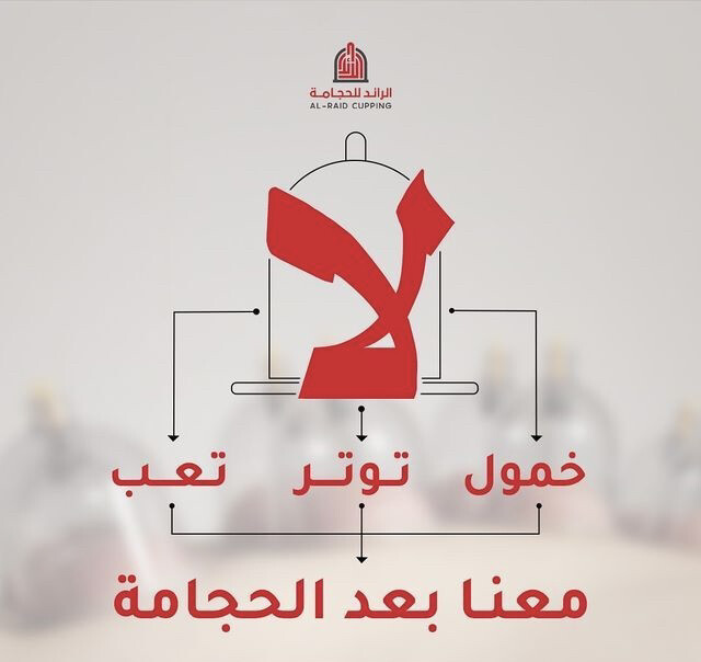 حجامه الخمول والكسل والارق - 1