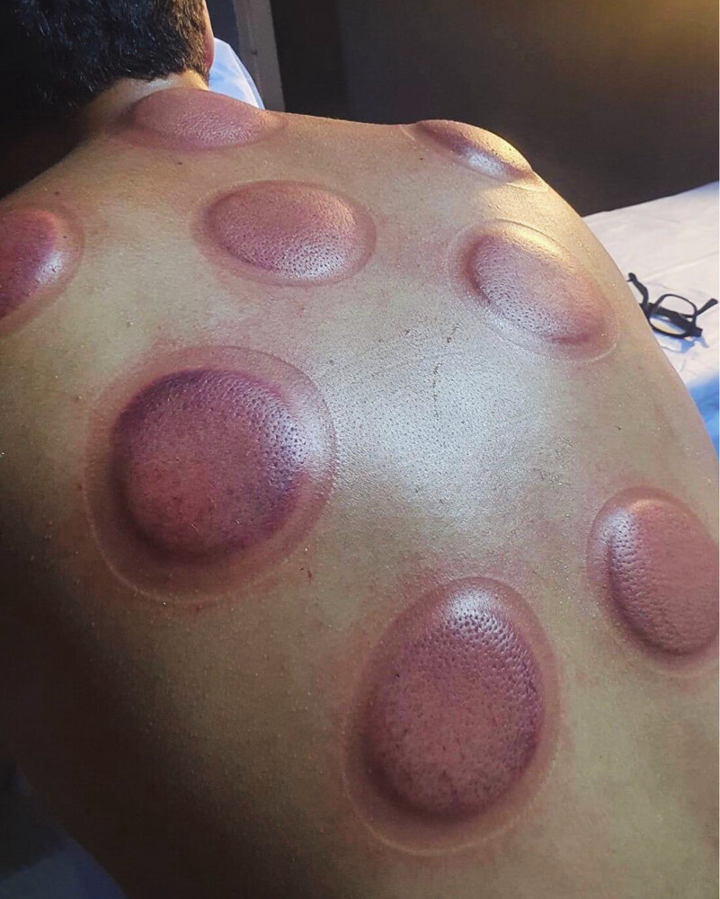 حجامه بايدي متخصصين خبره - 3