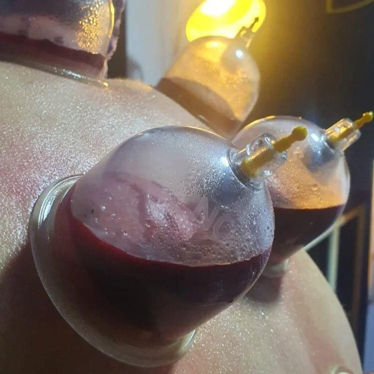 حجامه بايدي متخصصين خبره - 2
