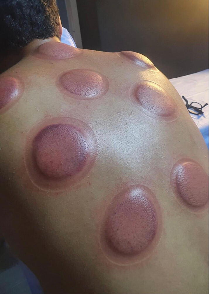 حجامه بايدي متخصصين خبره - 4