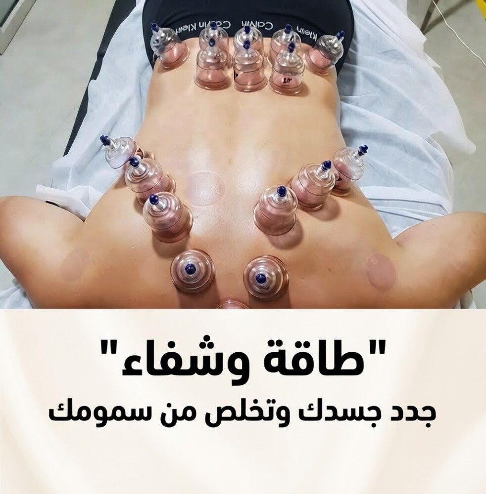 اخصائيين حجامه للرجال والنساء - 1