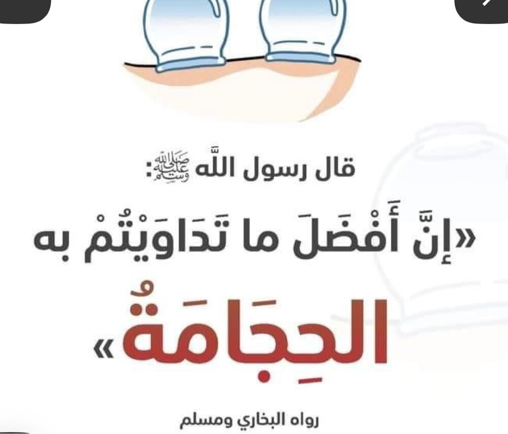 حجامة - 1