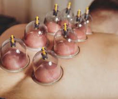 حجامة إسلامية