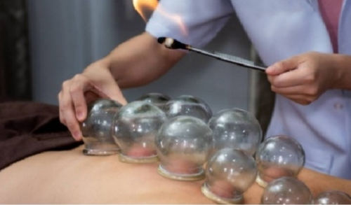 مركز دار الحجامة رجال ونساء