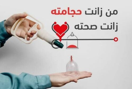 التداوي بالحجامه