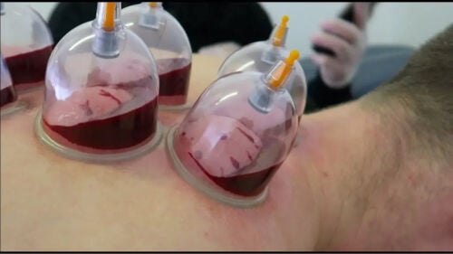 حجامه الراس بدون حلاقه الشعر 