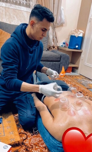 حجامه نبويه احتراف
