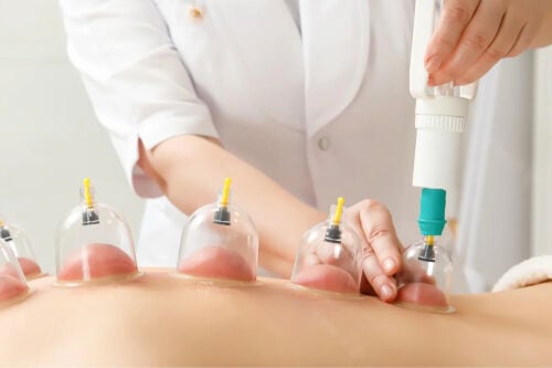 اخصائين حجامه للرجال والنساء 